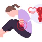 Endometriosis Treatment in Greater Noida West – Expert Care at Wonder Wombs